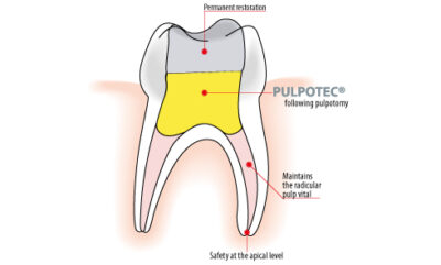 Pulpotec P/L - Image 2