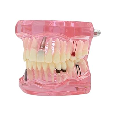 Study Model Molar Large Pink