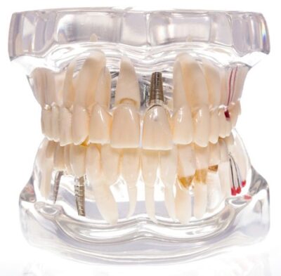 Study Model Molar Transparent Upper