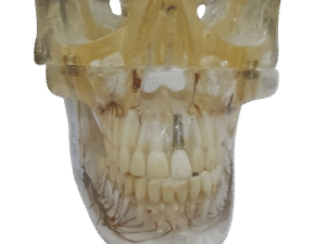 Study Model Molar Transparent Veins Sculpture