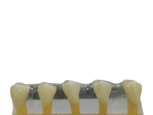 Study Model Molar Transparent 5pcs Strips