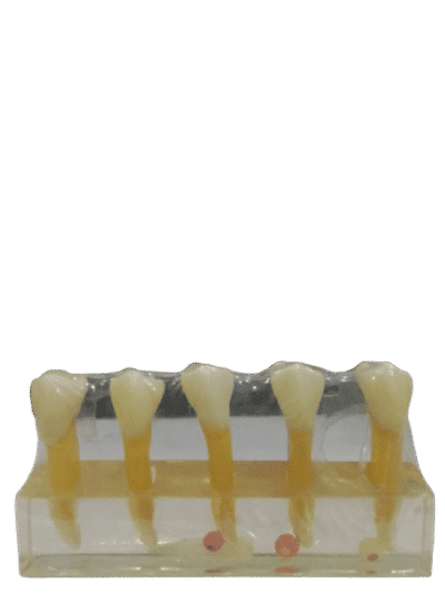Study Model Molar Transparent 5pcs Strips
