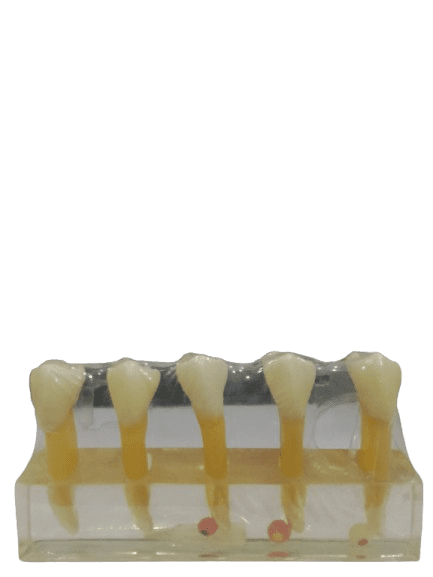 Study Model Molar Transparent 5pcs Strips
