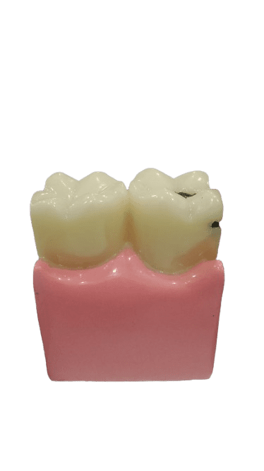 Study Model Molar Large Pink