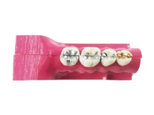 Study Model Molar Pink 4pcs Strips