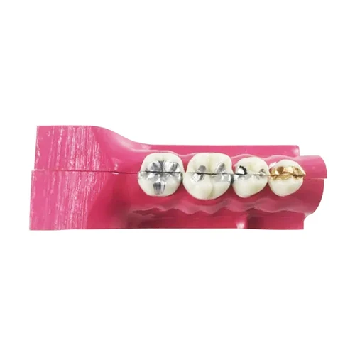 Study Model Molar Pink 4pcs Strips